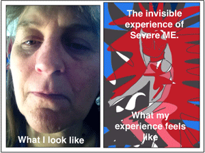 a photo of Linda and her unlying horrednous physical reality
. 